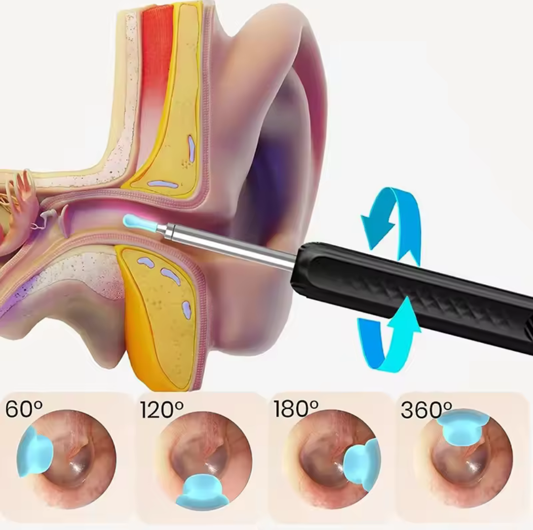 Smart Visual Ear Cleaner